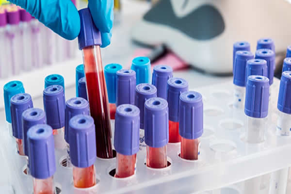 Convênios com o laboratório Rojan em Belo Horizonte