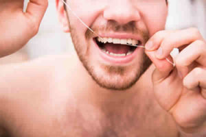 A marca do fio dental faz diferença na higiene dos dentes?